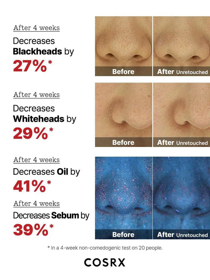 COSRX The AHA 2 BHA 2 Blemish Treatment Serum