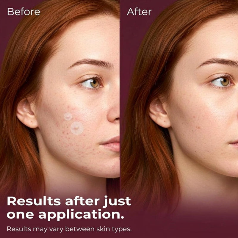 Patches and Pads Pimple Patches Spotted Night