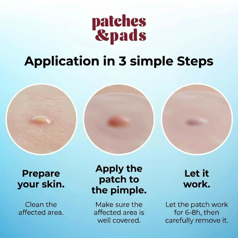 Patches and Pads Pimple Patches Underground