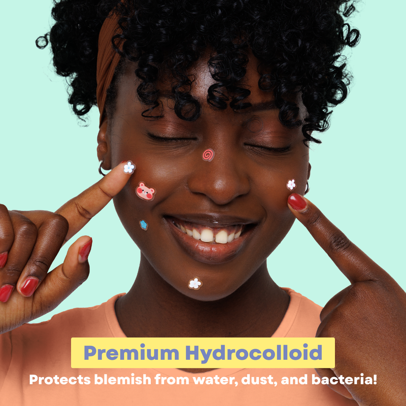 Rude Cosmetics Chibi Manga Collection Chibi Dotz! Pimple Patches Usagi Bloom, hydrocolloïde patches voor puistjes, foto 2 van