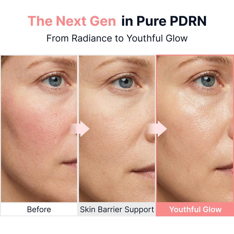 Sungboon Editor PDRN Pink Vitamin Glow Boosting Ampoule