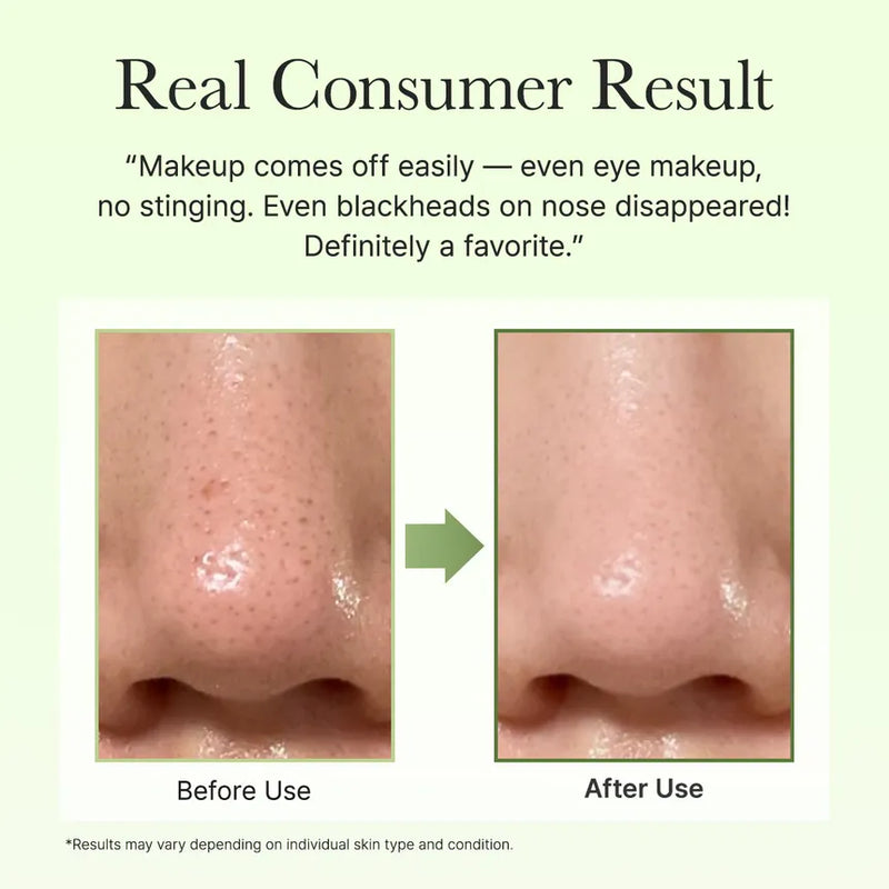 Arencia Pore Melt Phyto PDRN Cleansing Balm