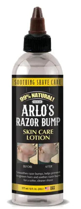 Arlo's Razor Bump Skin Care Lotion