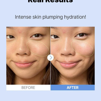 COSRX The Hyaluronic Acid 3 Serum