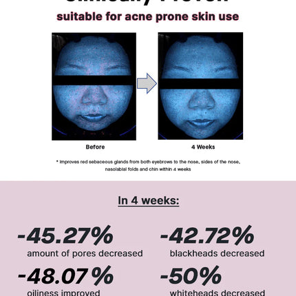 COSRX The Niacinamide 15 Serum