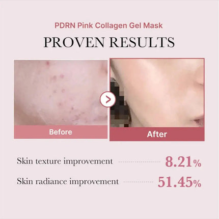 Medicube Pdrn Pink Collagen Gel Mask 4-Pack