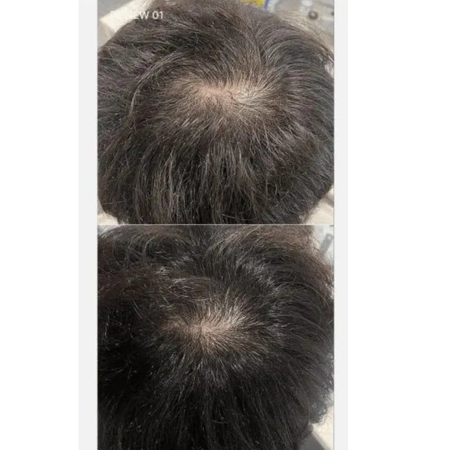 Medicube Soyxidil Shampoo