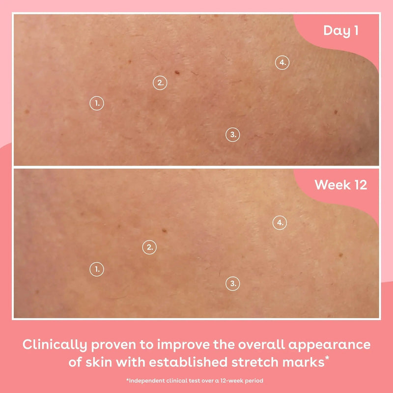 Q+A Collagen Body Oil